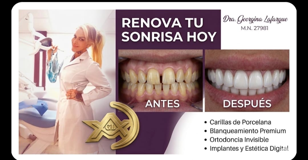 Dental Iluminate